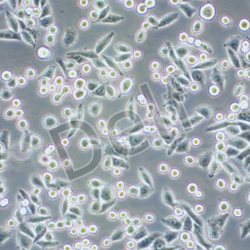 SW480 人結(jié)腸腺癌細(xì)胞