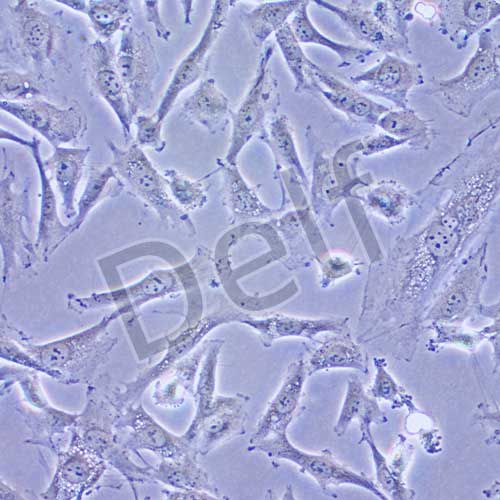 SW579 人甲狀腺癌細(xì)胞