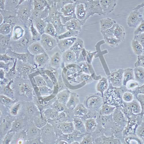 SW-780 人膀胱移行細胞癌