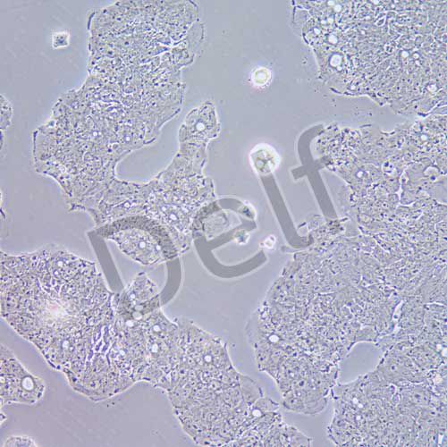 SW948 人結(jié)腸腺癌細(xì)胞