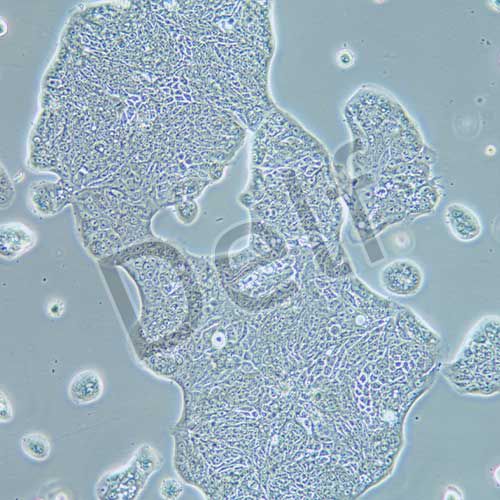SW1116 人結(jié)腸腺癌細(xì)胞