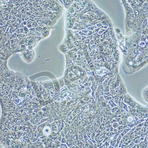 SW1116 人結(jié)腸腺癌細(xì)胞