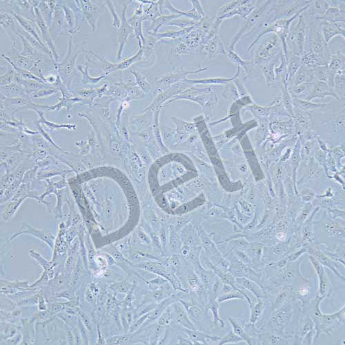 SW-1353 人骨肉瘤細(xì)胞