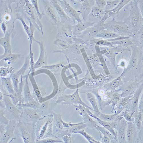 SW-1353 人骨肉瘤細(xì)胞
