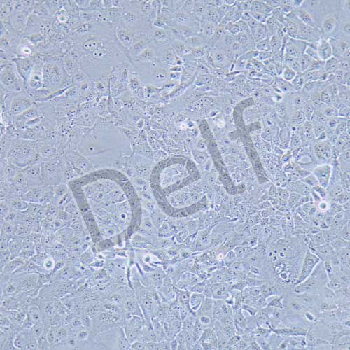 SW1990 人胰腺癌細(xì)胞