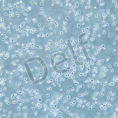 T2 (174xcem.T2 )人淋巴母細(xì)胞