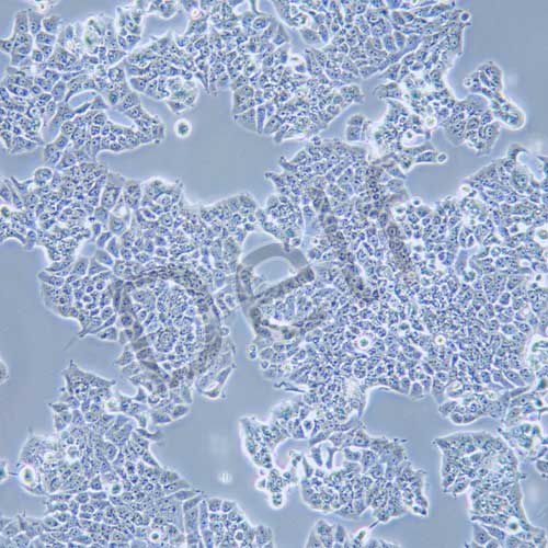 T47D 人乳腺導(dǎo)管癌細(xì)胞