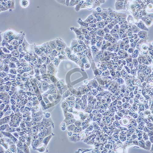 T47D 人乳腺導(dǎo)管癌細(xì)胞