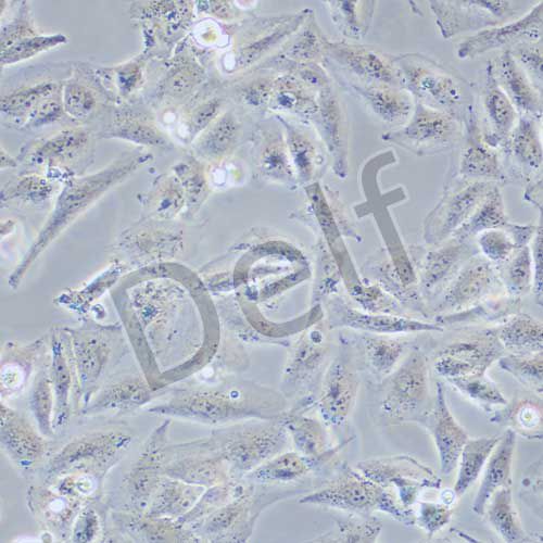 TCCSUP 人膀胱癌細(xì)胞