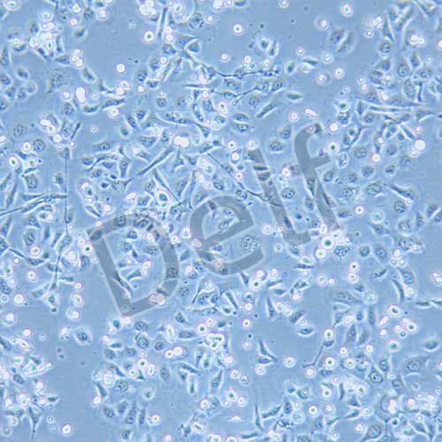 TE-1 人食管癌細(xì)胞