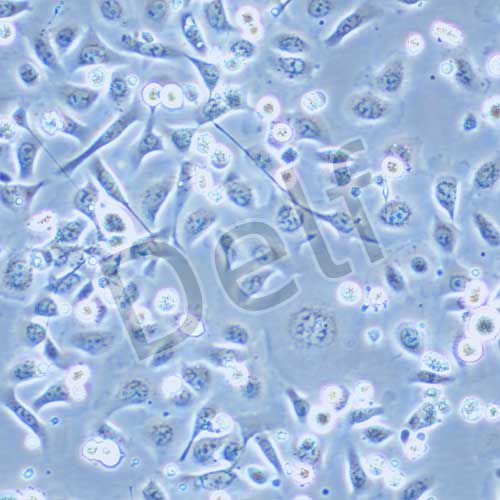 TE-1 人食管癌細(xì)胞