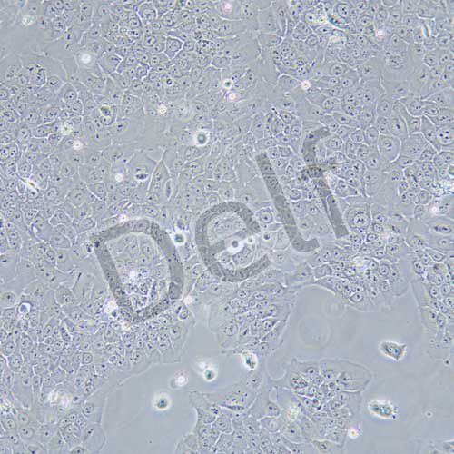 TE-13 人食管癌細(xì)胞