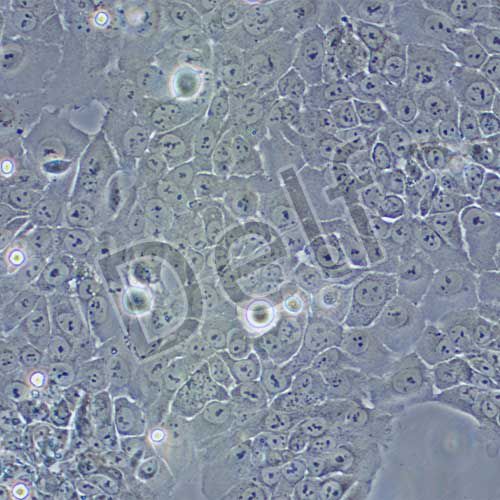 TE-13 人食管癌細(xì)胞