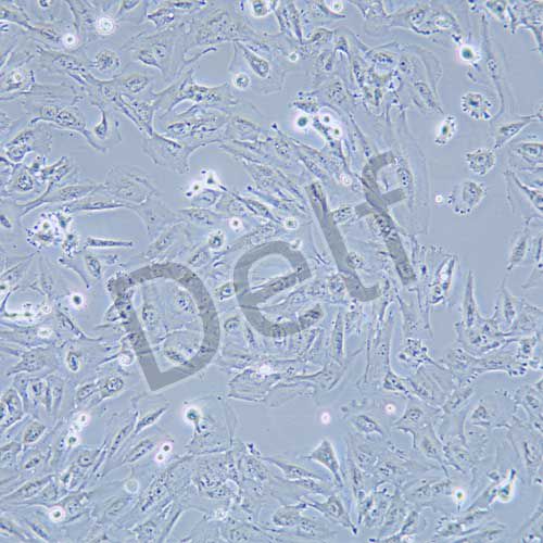 TJ905 人膠質(zhì)瘤細(xì)胞