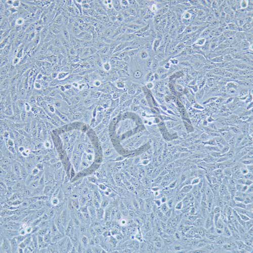 TPC-1 人乳頭狀甲狀腺癌細胞