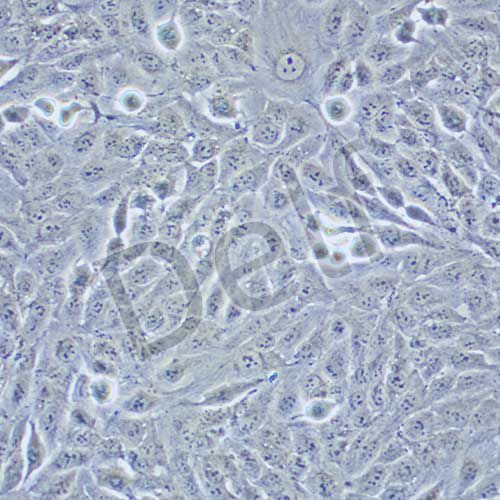 TPC-1 人乳頭狀甲狀腺癌細胞