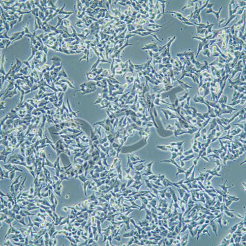 TT 人甲狀腺癌細(xì)胞