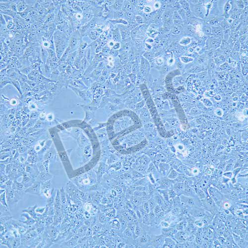 TU138 人喉癌細(xì)胞