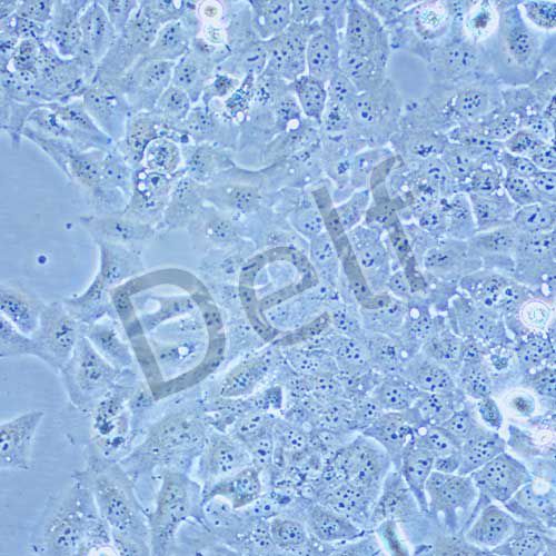 TU138 人喉癌細(xì)胞