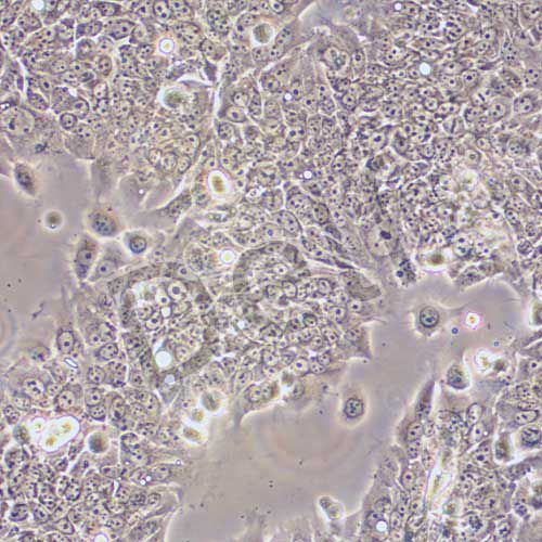 TU212 人喉癌細(xì)胞