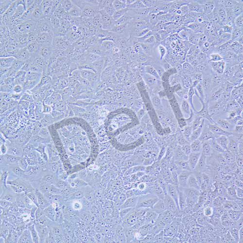 TU686 人喉癌細(xì)胞