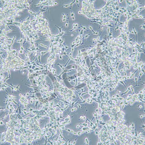 U14 小鼠子宮頸癌細(xì)胞