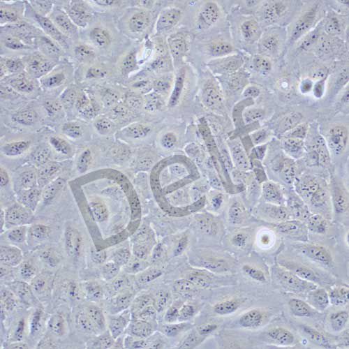 U2OS 人骨肉瘤細(xì)胞