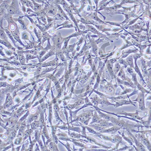 U251MG 人類星型膠質(zhì)細(xì)胞瘤