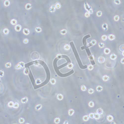 U266 人骨髓瘤細胞