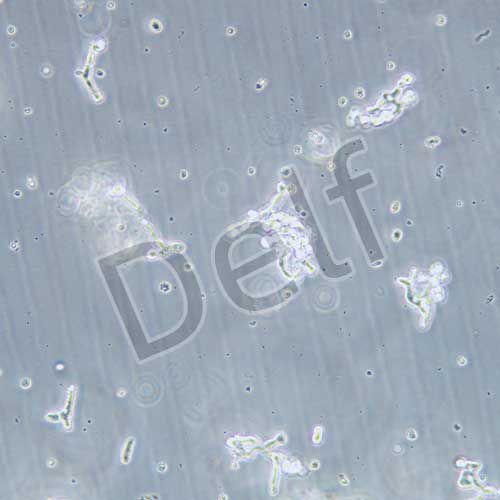 WERI-RB-1 人視網(wǎng)膜神經(jīng)膠質(zhì)瘤細(xì)胞