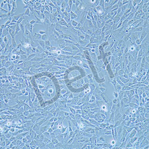 WPMY-1 人正常前列腺基質(zhì)永生化細胞