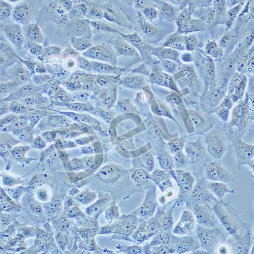 WPMY-1 人正常前列腺基質(zhì)永生化細胞