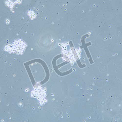 Y79 人視網(wǎng)膜母細(xì)胞瘤細(xì)胞