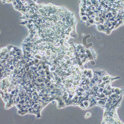 ZR-75-1 人乳腺癌細(xì)胞