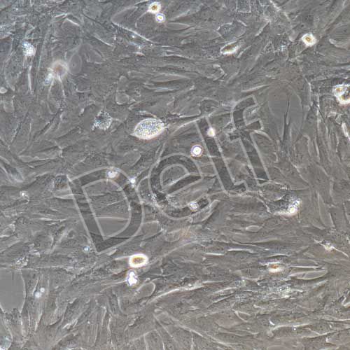 大鼠原代膀胱基質(zhì)成纖維細(xì)胞