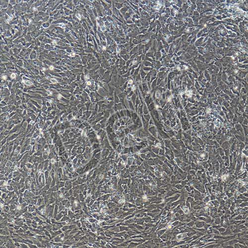 大鼠原代肺微血管內(nèi)皮細胞