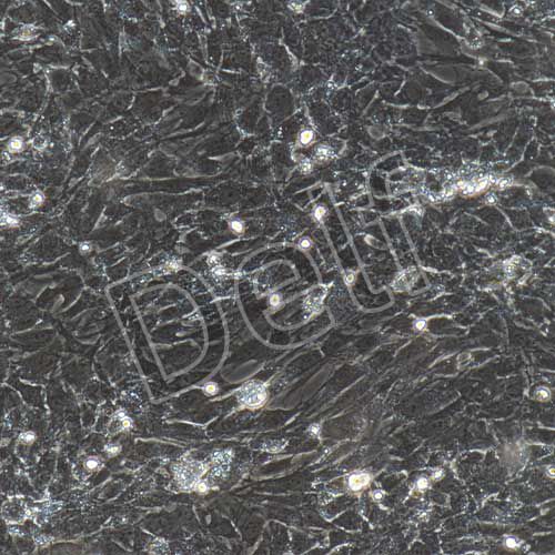 大鼠原代肺微血管內(nèi)皮細胞