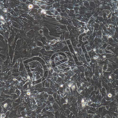 大鼠原代肺微血管內(nèi)皮細胞