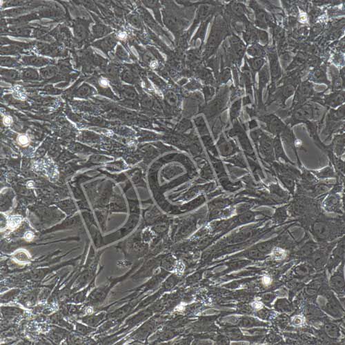 大鼠原代肝星狀細(xì)胞