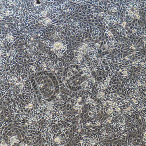 大鼠原代臍靜脈內(nèi)皮細(xì)胞