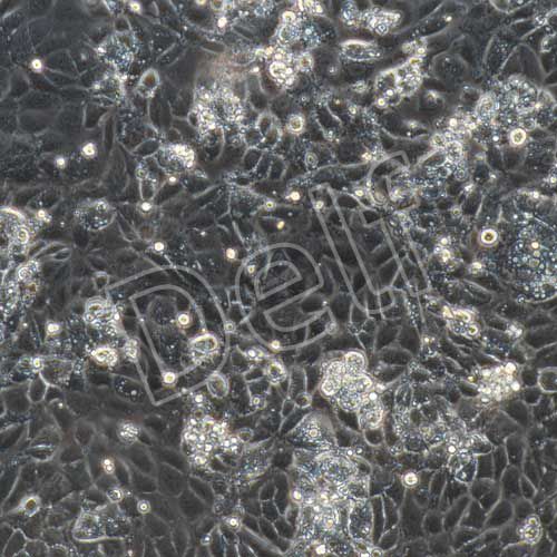 大鼠原代臍靜脈內(nèi)皮細(xì)胞