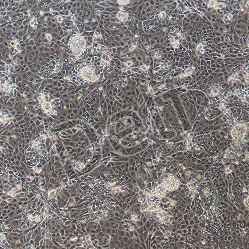 大鼠原代視網(wǎng)膜色素上皮細(xì)胞