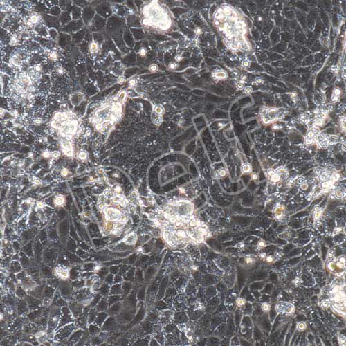 大鼠原代視網(wǎng)膜色素上皮細(xì)胞