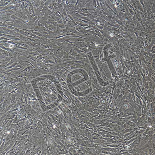 大鼠原代心肌成纖維細胞