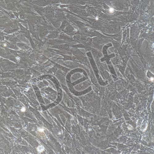 大鼠原代心肌成纖維細胞