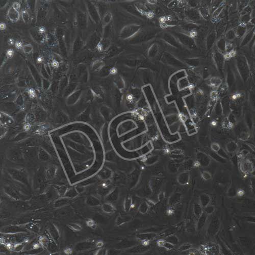 大鼠原代主動(dòng)脈內(nèi)皮細(xì)胞