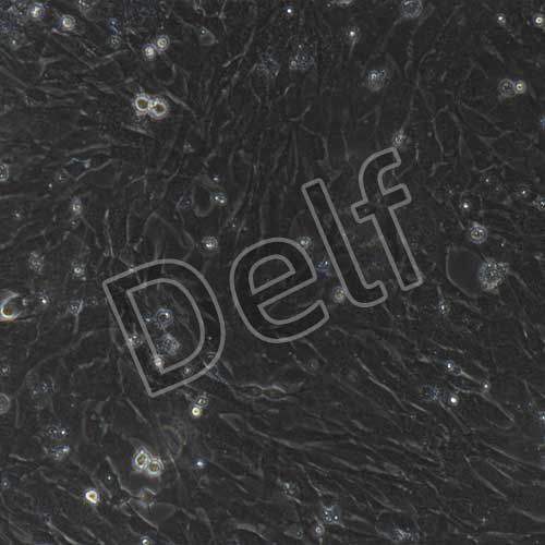 鴨原代腦微血管內(nèi)皮細(xì)胞