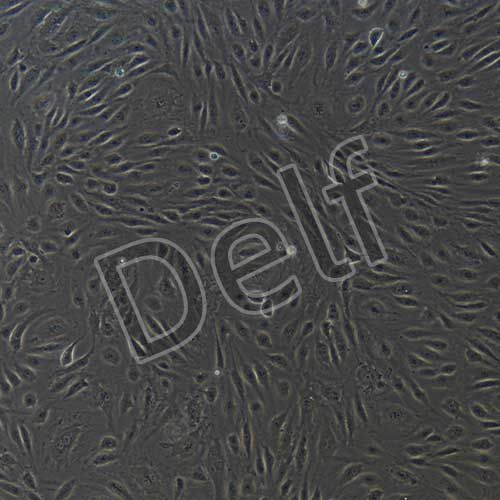 HUVEC 人臍靜脈內皮細胞永生化