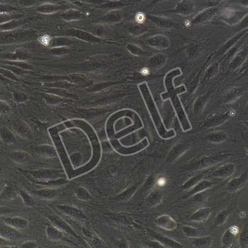 HUVEC 人臍靜脈內皮細胞永生化