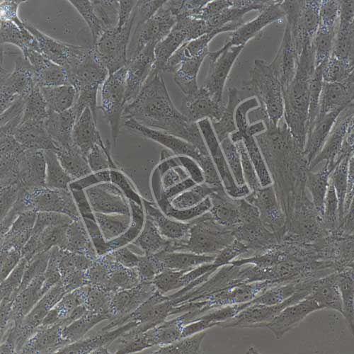 人原代肺癌成纖維細胞